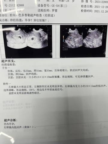journal_insert_pic_1687887568