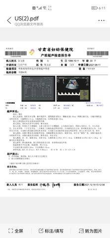 journal_insert_pic_1677743866