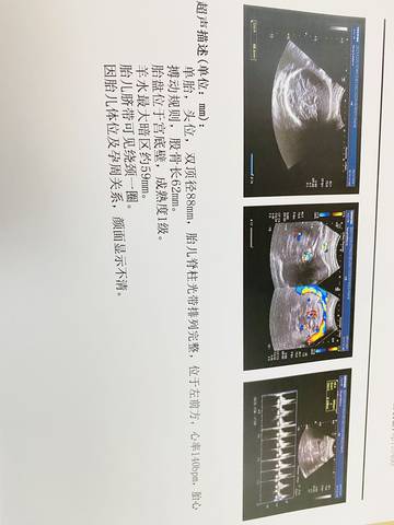 journal_insert_pic_1688226414