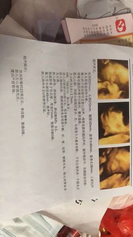 journal_insert_pic_1677381783