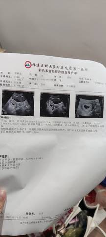 journal_insert_pic_1719674021