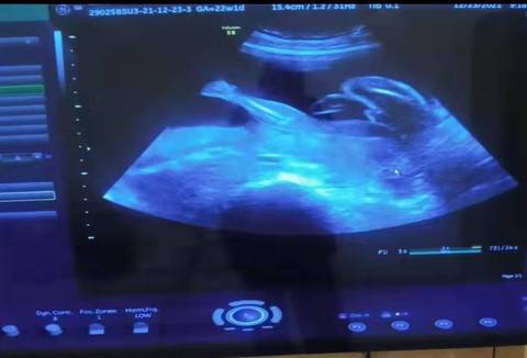 journal_insert_pic_1684869477