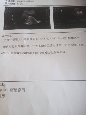 journal_insert_pic_1683480225