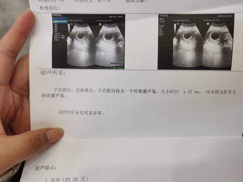 journal_insert_pic_1684173184