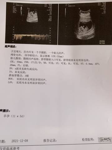 journal_insert_pic_1675947289