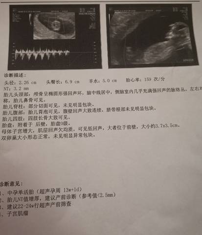 journal_insert_pic_1688604458