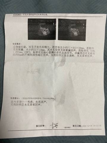 journal_insert_pic_1681093259