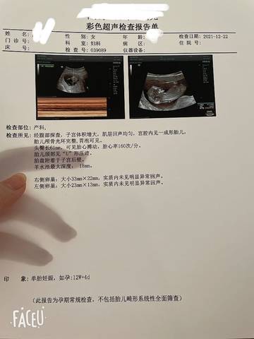 journal_insert_pic_1684227354