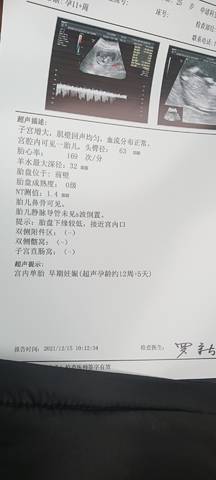 journal_insert_pic_1684175613