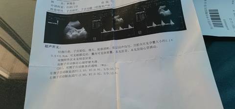 journal_insert_pic_1684963671
