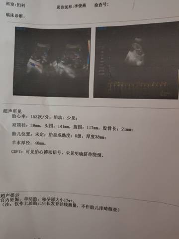 journal_insert_pic_1674386823