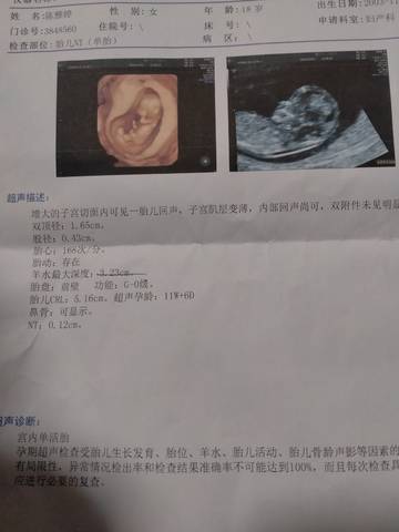 journal_insert_pic_1675552339