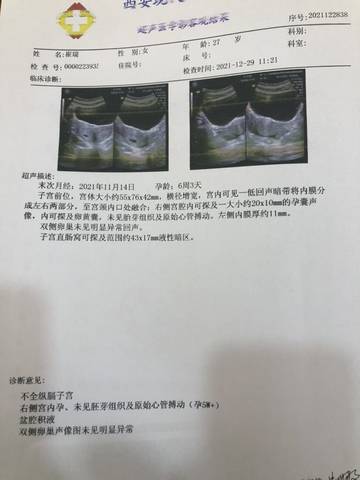 journal_insert_pic_1688284144