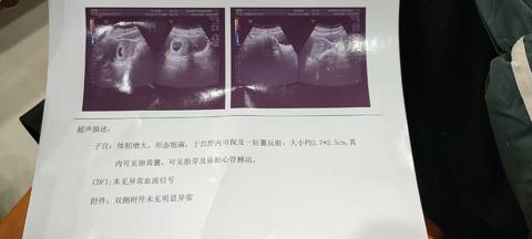 journal_insert_pic_1687283676