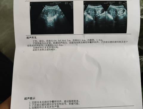 journal_insert_pic_1740938908