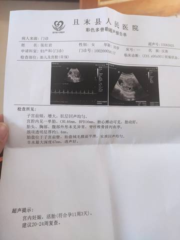 journal_insert_pic_1675456544