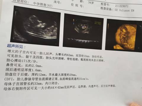 journal_insert_pic_1684990803