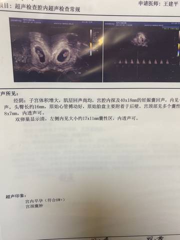 journal_insert_pic_1684842637