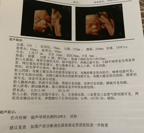 journal_insert_pic_1686028210