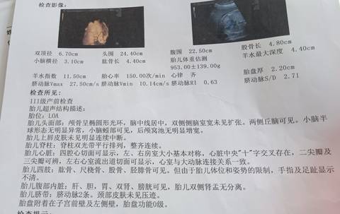 journal_insert_pic_1690385298