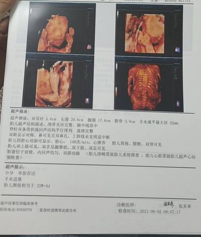 journal_insert_pic_1674349103
