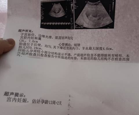 journal_insert_pic_1685980539