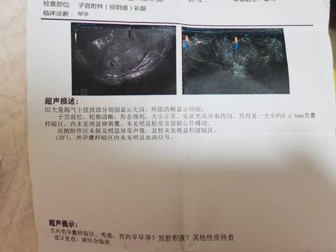 journal_insert_pic_1681145413