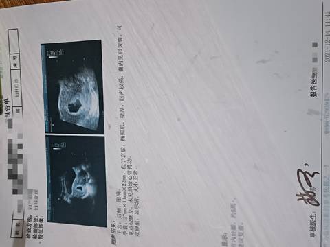 journal_insert_pic_1684550955