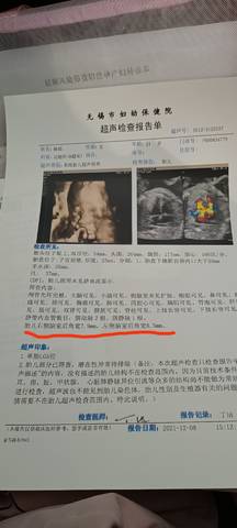 journal_insert_pic_1676990413