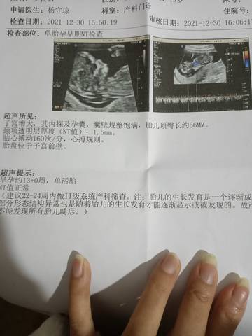 journal_insert_pic_1689059911