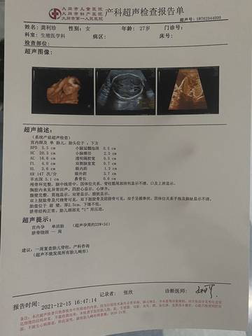 journal_insert_pic_1683463788