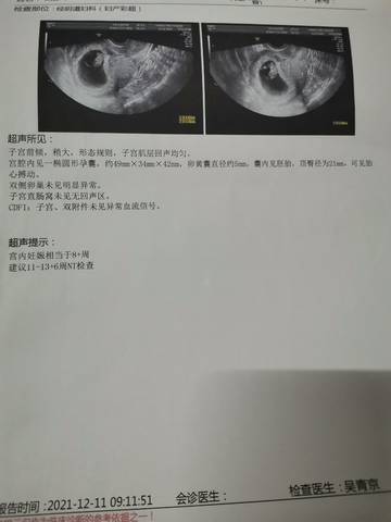 journal_insert_pic_1678103587