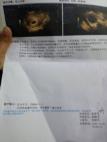 journal_insert_pic_1683320931