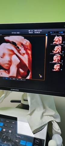 journal_insert_pic_1690037623