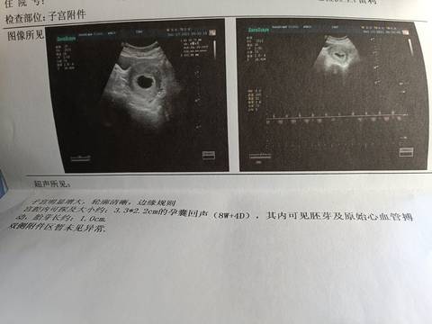 journal_insert_pic_1681568569