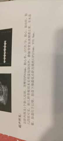 journal_insert_pic_1740807925
