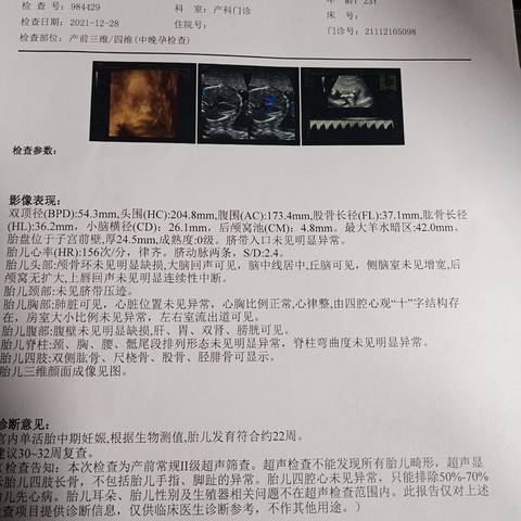 journal_insert_pic_1688191112