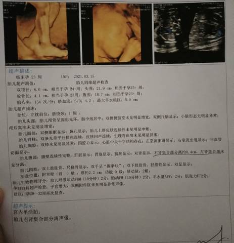 journal_insert_pic_1678517277