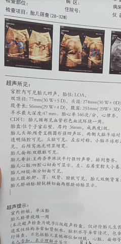 journal_insert_pic_1679569232