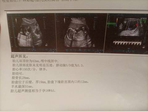 journal_insert_pic_1674094106