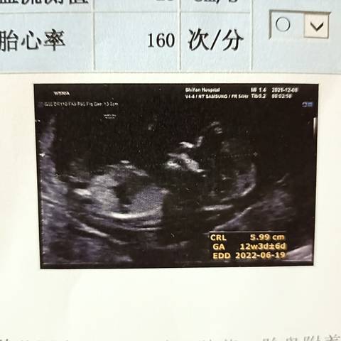 journal_insert_pic_1675958499