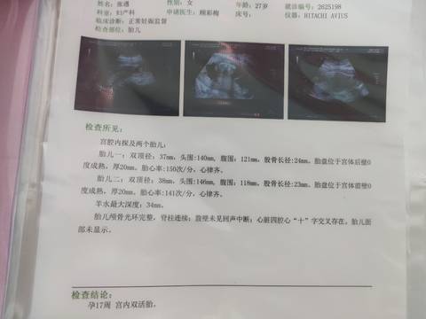 journal_insert_pic_1688500872