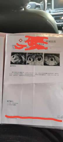 journal_insert_pic_1685286776