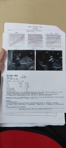 journal_insert_pic_1689822774