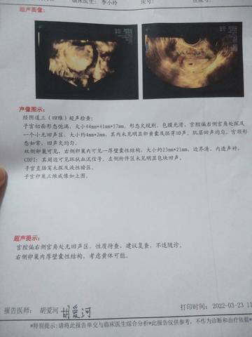 journal_insert_pic_1740894820