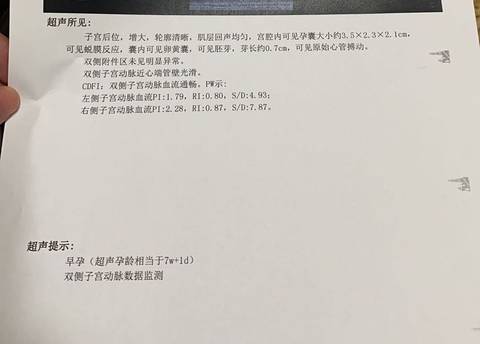 journal_insert_pic_1683557442