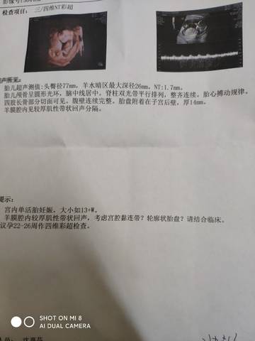 journal_insert_pic_1685434336
