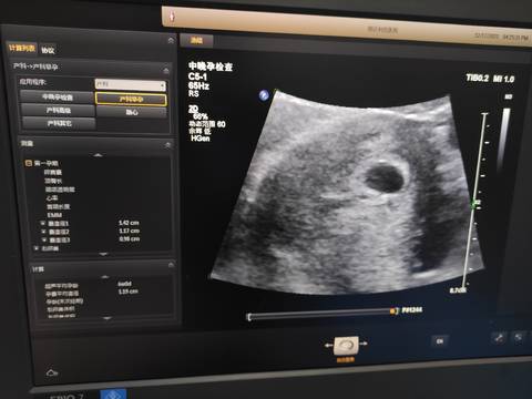 journal_insert_pic_1681667420