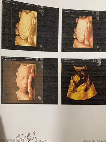 journal_insert_pic_1683136241