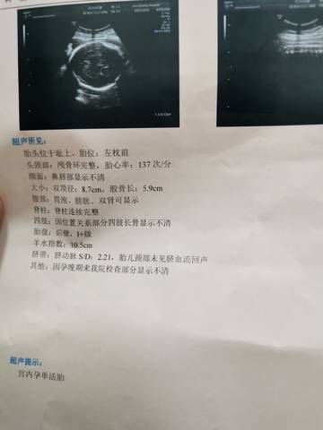 journal_insert_pic_1684020643